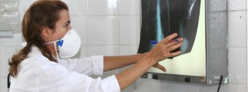Brasil se aproxima de padrão positivo de combate à tuberculose, mostra relatório
